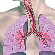 Rhetoric Aside, a Less Publicized Goal in WADA Ban of Asthma Medications: Healthy Athletes